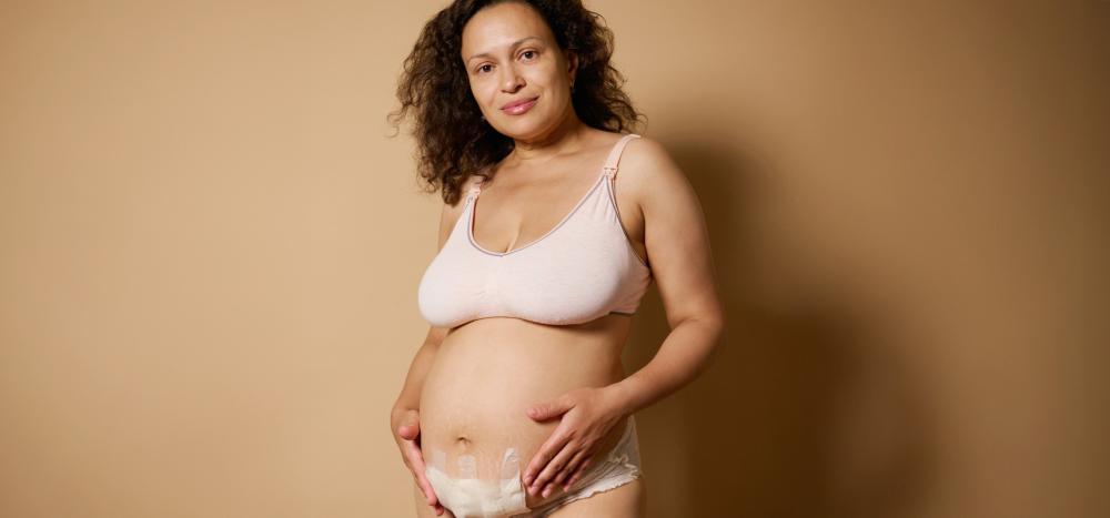 pregnant woman preparing for c-section